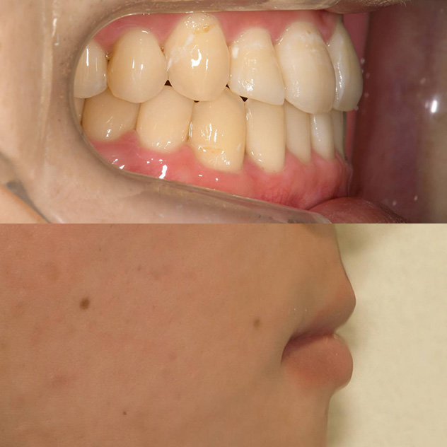治療後